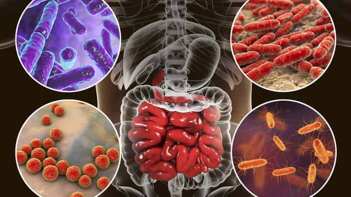 disbiosis intestinal