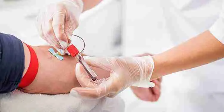 Prolactina alta: 8 posibles causas 2 analisis-sangre prolactina alta