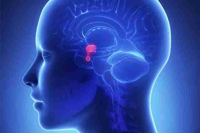 Prolactina alta: 8 posibles causas 3 prolactinoma